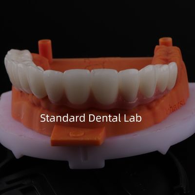 comprar Bom ajuste de precisão estética zircônio porcelana coroa rosa porcelana com sombra de branqueamento fabricação em linha
