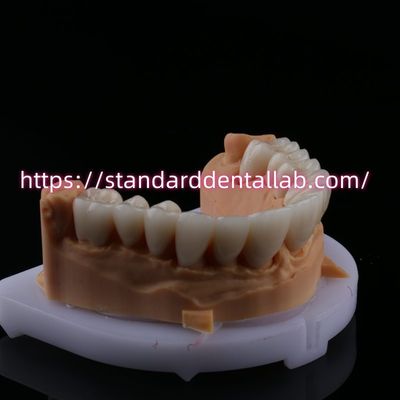 comprar FDA Alta Estética Dental Zirconia Ponte Com Coroa Dental de Zirconia de Porcelana Camadas China Dental Lab fabricação em linha