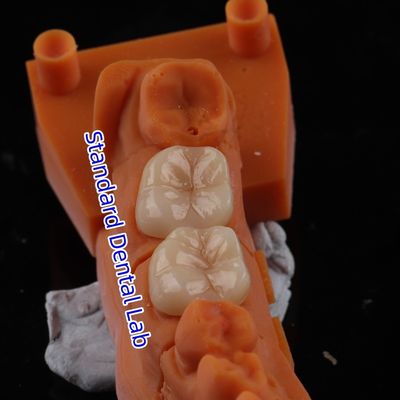 comprar Full Contour Circonia coroa translúcida 3D PRO sem revestimento de porcelana fabricação em linha