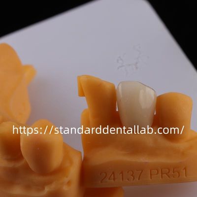 comprar Coroas de laboratório dentário de contorno completo de alta translucidez fabricação em linha