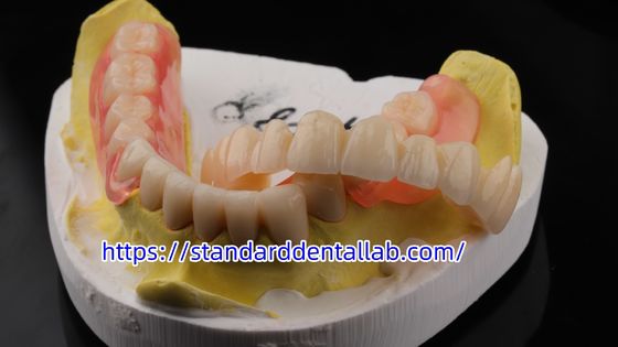 comprar Alta Estética Dentária TCS Valplast Flexível Dentes Parciais Dentários Valplast Laboratório Clap Rosa fabricação em linha