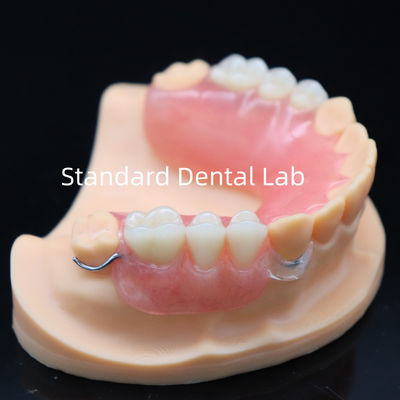 comprar Prótese parcial acrílica de alta estética com fecho transparente e dentes acrílicos China Dental Lab fabricação em linha