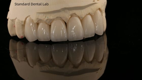 comprar Coroa de zircônio de contorno completo e ponte dentária natural de alta estética 5 anos de garantia fabricação em linha