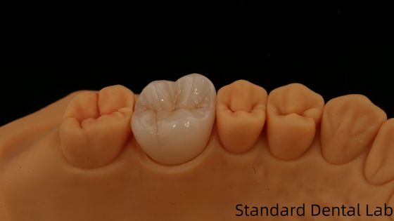 comprar Noritake porcelana de contorno completo coroa de zircônio personalizado sombra de vita para estética digital restauração dentária por laboratório dentário fabricação em linha