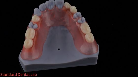 comprar Modelo de impressão 3D Alta estética Dental TCS Valplast Flexíveis Dentes Parciais Dentários Laboratório Dental fabricação em linha