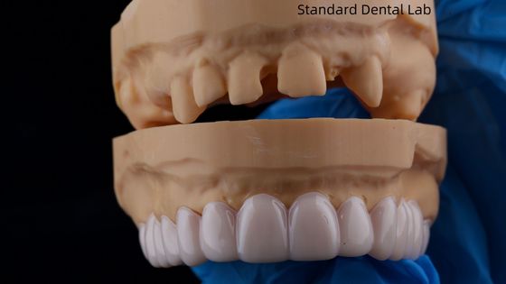 comprar Alta estética Dental Snap On Smile Dental Lab padrão aparelho dental removível fabricação em linha