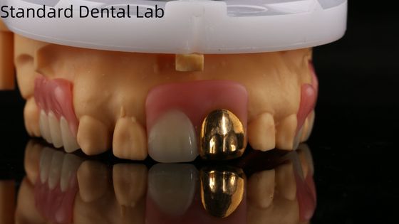 comprar Dentes de acrílico completo com dentes de ouro amarelo/dentária temporária dentadura de acrílico Ivoclar profissional aprovada pela FDA fabricação em linha