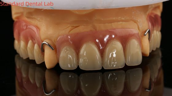 comprar Prótese dentária Ivoclar parcial acrílica curada a calor Laboratório dentário de alta precisão com modelo de impressão 3D fabricação em linha
