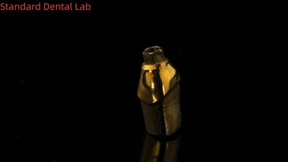 comprar Abutments de titânio puro personalizados A solução perfeita para restaurações dentárias fabricação em linha