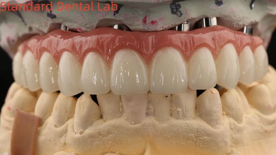 comprar Porcelana All On Four Ponte de zircônio Alta estética Implante dentário Ponte parafuso retido fabricação em linha