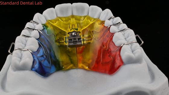 comprar Expansão Dental e Distalização Ortodontista Palate Expander China Laboratório Dental fabricação em linha