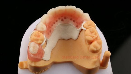 comprar Peek Design de Quadro Parcial ISO CE e FDA Laboratório Dental Quadro de Dentadura Parcial Acrílica fabricação em linha