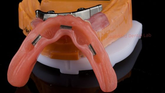 comprar Ivoclar Digital Dental Implant Bar Denture com anexos Denture Full Acrylic Denture Denture Titanium Implant Supported Dentures fabricação em linha