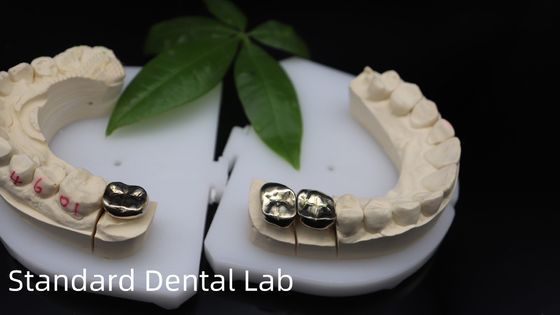 comprar Profissional ISO e FDA aprovado coroa de ouro amarelo para laboratório dentário Envio UPS ou Fedex Tempo de produção 2 dias fabricação em linha