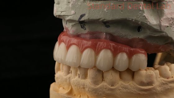comprar Implantação dentária de titânio híbrido parafuso retido coroa todos em 4 Implantação dentária Zirconia ponte fabricação em linha
