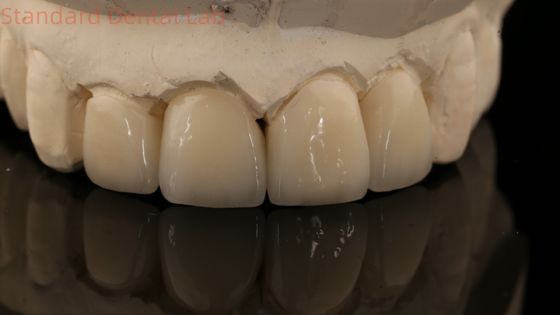 comprar Coroa e ponte de zircônio de camadas fortes em boa estética laboratório dentário de zircônio de camadas da China fabricação em linha