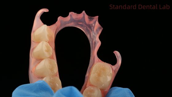comprar Dental TCS Valplast Dentes parciais flexíveis Laboratório Dental Impressão 3D Modelo Alta Estética fabricação em linha