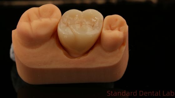 comprar Moinho e Centramento Coroa de Zircônio Completo, Laboratório Dental da China Entrega rápida fabricação em linha