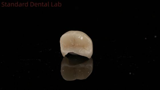 comprar Coroa de zircônio translúcida dentária incrustada Coroa onlay para restaurar a forma natural da cavidade fabricação em linha