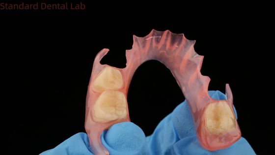 comprar Impressão 3D Modelo Dental TCS Valplast Dentes Parciais Flexíveis Cor Rosa / Escura Produto de Laboratório Dental fabricação em linha