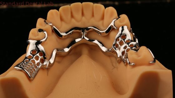 comprar Quadro de metal fundido superior Dentes parciais fortes Leve e durável fabricação em linha