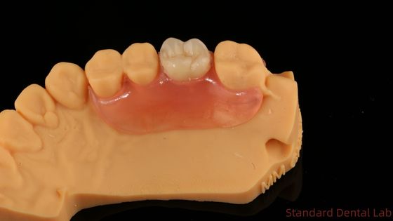 comprar Dental TCS Valplast Flexíveis Dentes Parciais Nesbit Valplast Finish China Dental Lab Valplast Clamps fabricação em linha