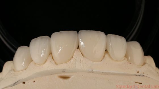 comprar Ponte de coroa de zircônio de precisão confortável / estética 3-4 dias Tempo de entrega rápido fabricação em linha