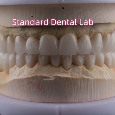Laboratório Dentário Arco Completo Zirconia Coroas de Porcelana PFZ Coroa ISO FDA CE
