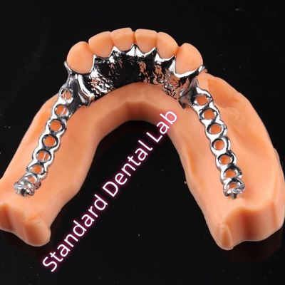 Impressão a laser Cobalto Cromo Quadro de metal Dentadura parcial Ni Be Free