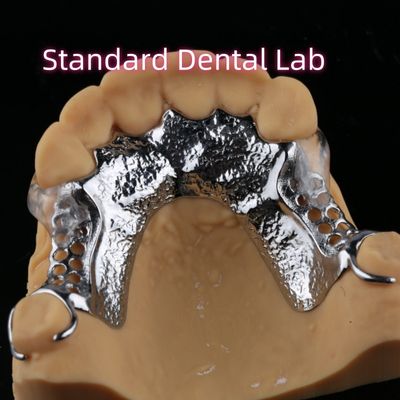 Impressão a laser Dentadura parcial de cobalto cromo com pinças transparentes