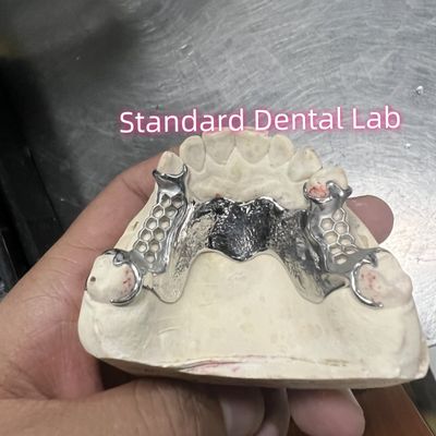 Quadro fundido de cromo de cobalto dentadura parcial Vitallium 2000