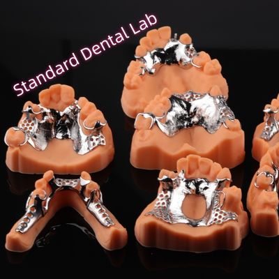 CAD CAM Estrutura de Dentadura Parcial Removível 3Forma Exocad