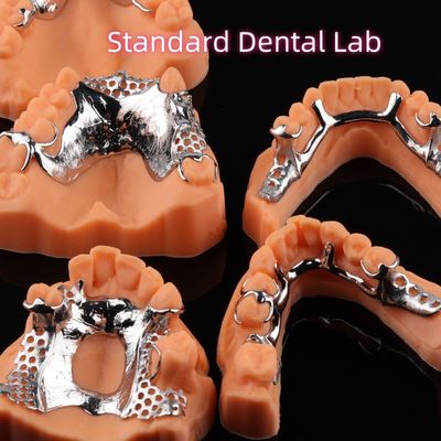 Impressão CoCr Dentura Esqueleto Cromo Metal Parcial Dentura Design