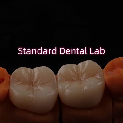 Full Contour Bruxier Monolithic Zirconia Crown Bridge Laboratório Dental