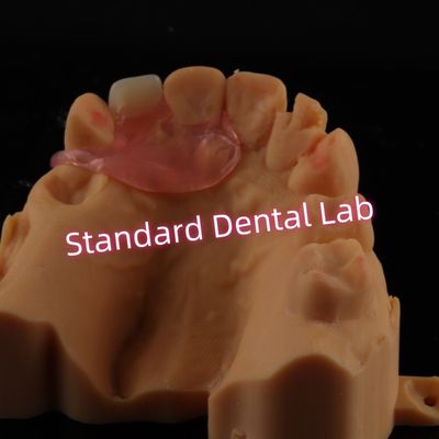 Dentes dentários unilaterais removíveis flexíveis de um dente