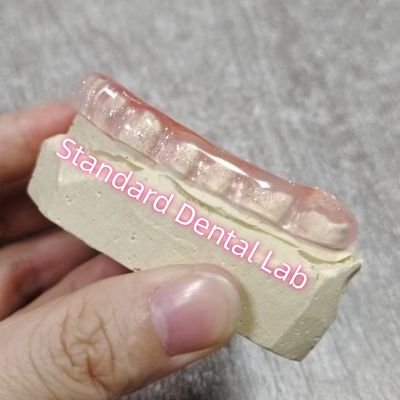 Bruxismo Odontológico Oclusal Fenda Laboratório Odontológico Padrão da Guarda Noturna
