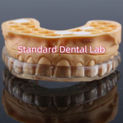 Proteção Dental Profissional Anti-Resonância Profissional Proteção Dental Noturna Atualizada Proteção Bucal Para Amarração de Dentes