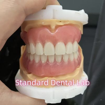 Laboratório Odontológico Padrão OEM Dentes removíveis completos Fácil de levar e tirar