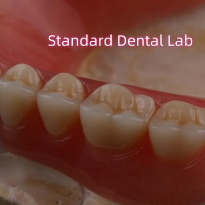 SDL Dentes Parciais de Dentadura Acrílica Curada à Quente Laboratório Dental Ivoclar Alta Precisão