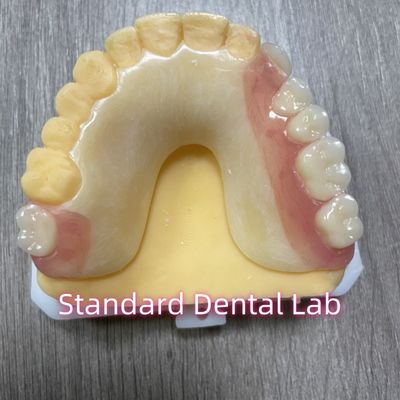 OEM Removível Cast Tooth Shade Prótese parcial acrílica com grampos