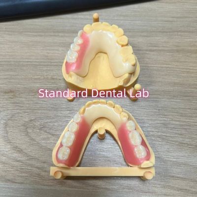 Tinta de dente estética Estrutura acetalo Tintas de cor de dente Ivoclar