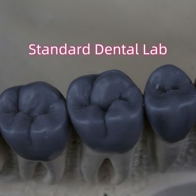 Profissional Digital Dental Lab Wax Up 3shape aprovado pela FDA