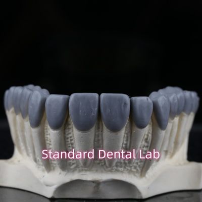 Laboratório Dental Padrão Coroa Dental de cera alta estética