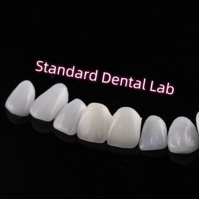 Resistente à abrasão Emax Zirconia Veneers laminados Translucidez incisiva