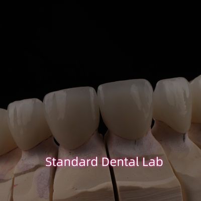 PFZ ponte de zircônio cerâmica de camada dentária com incisão translúcida