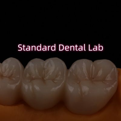 Ponte de zircônio em camadas de PFZ de alta translúcido, porcelana cerâmica