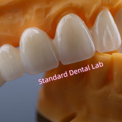 CAD CAM Moinho Zirconia Crown Bridge Altamente Biocompativel