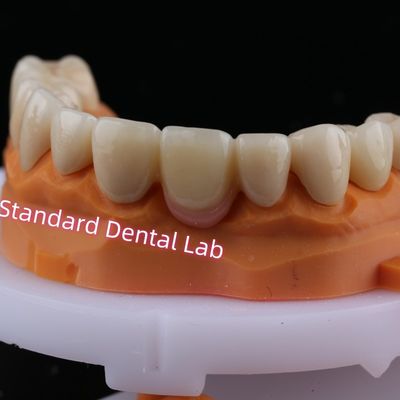 Digital CAD CAM moagem de zircônio ponte em camadas coroa com porcelana rosa