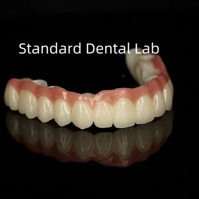 Estética Porcelana monolítica Coroa de zircônia Translucidez de arco completo