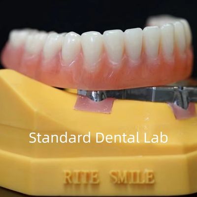Dentaduras de apoio a implantes de titânio Dentaduras Ivoclares de precisão sobre implantes ISO FDA CE
